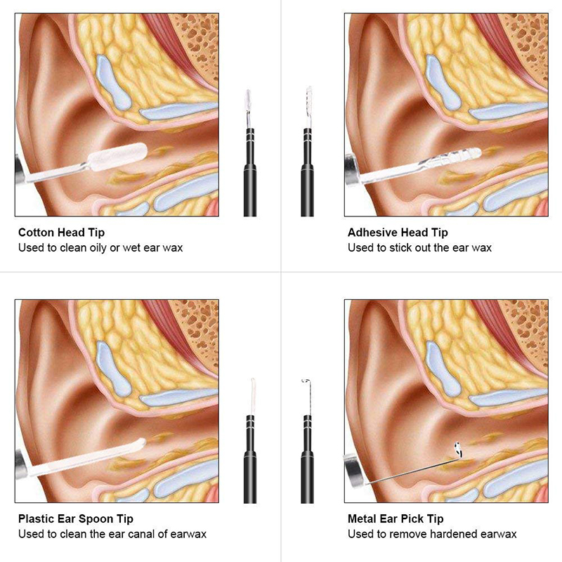 Wifi Otoscope 3 in 1 Ear Wax Remover Tool 720P vedenpitävä kamera 6 säädettävällä LEDillä yhteensopiva Android- ja iOS-järjestelmien kanssa