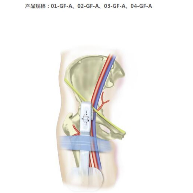 Kultasormi Electronic Femoral Hemostasis -kompressointilaite