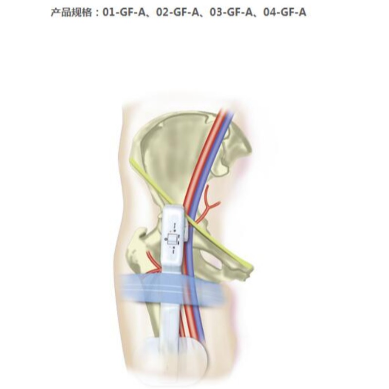 Kultasormi Electronic Femoral Hemostasis -kompressointilaite